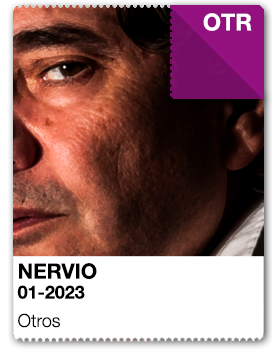 nervio
